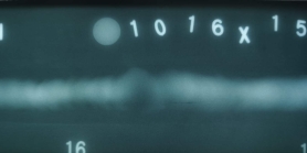 請(qǐng)大家看看這是未熔合還是裂紋