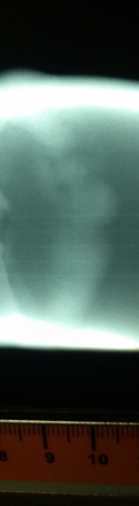 請教大家看以下片子如何解釋