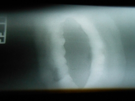 60*9.5不銹鋼管子，請(qǐng)教看有什么缺陷？