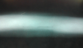 這次RTII考試實習的時候看的兩張片子，請各位老師講解一下