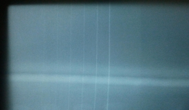 請問這是什么缺陷？