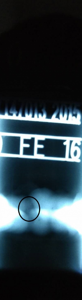 請大神看看圓圈內(nèi)是什么