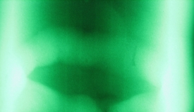 考試復習缺陷底片1