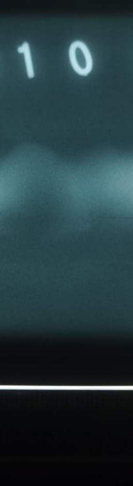 請大家看看這是未熔合還是裂紋