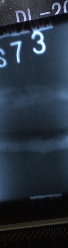 內(nèi)凹評(píng)定