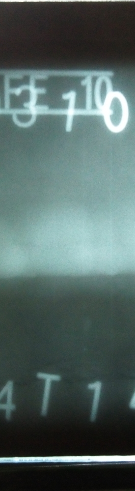 幾張裂紋的底片