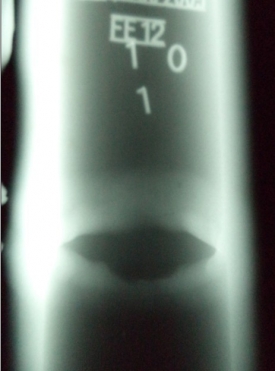 本焊口的底片評定，求解！