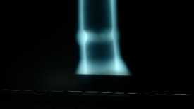 求教管焊縫底片