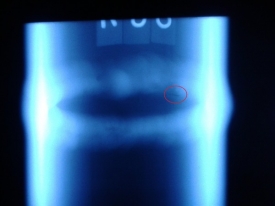 該底片如何評定？